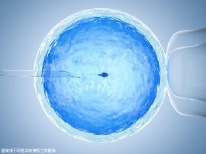 全球医疗